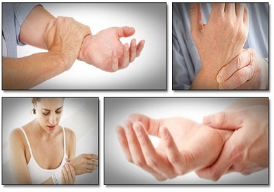 Simple Carpal Tunnel Treatment